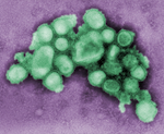 Is it the Flu&##x3f;